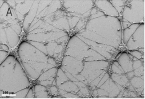 Figure 1: Primary culture morphology of E18 rat hippocampal neurons at 5 days in culture on glass slides.